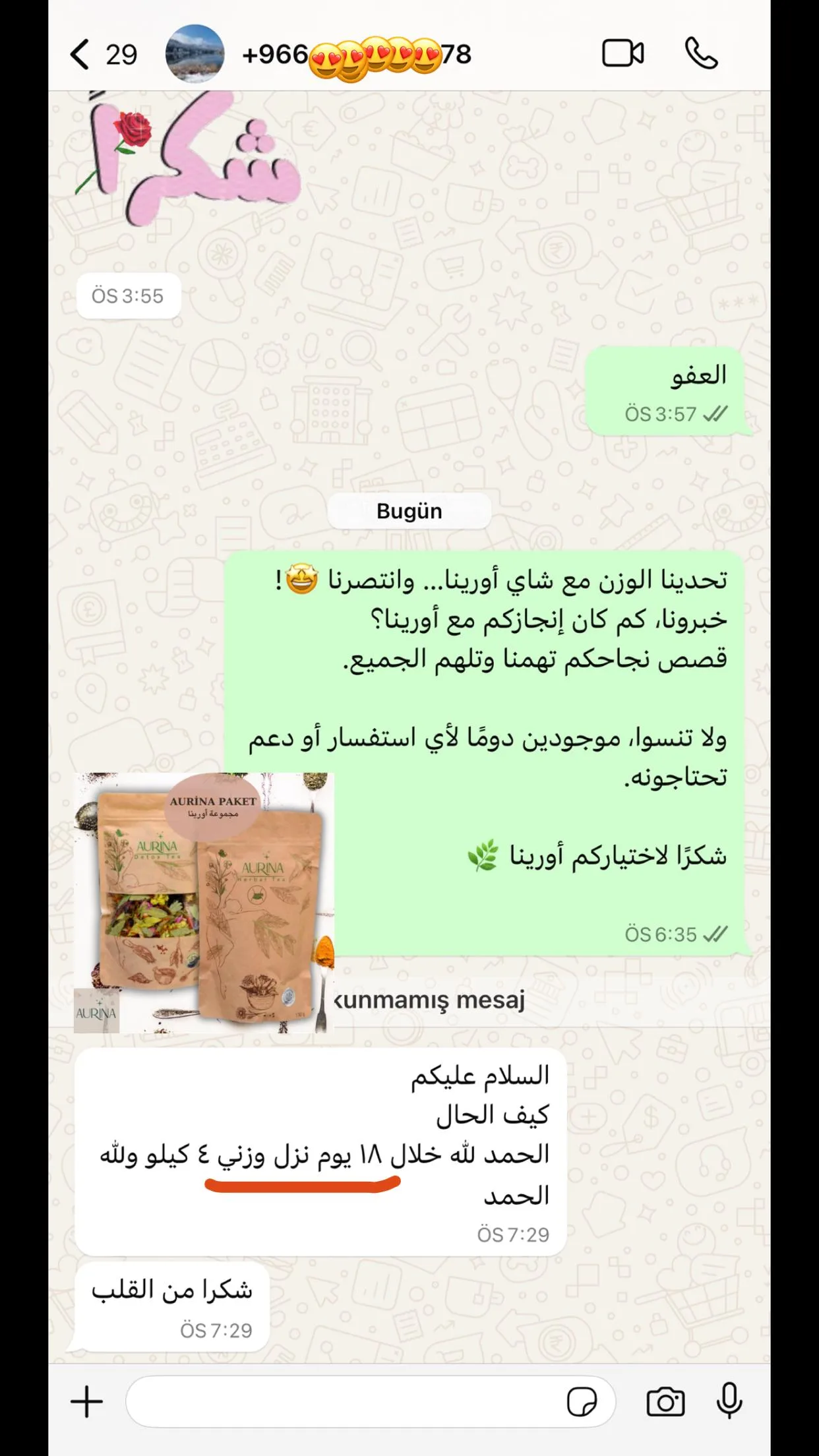 رأي عميلة أورينا رقم 43